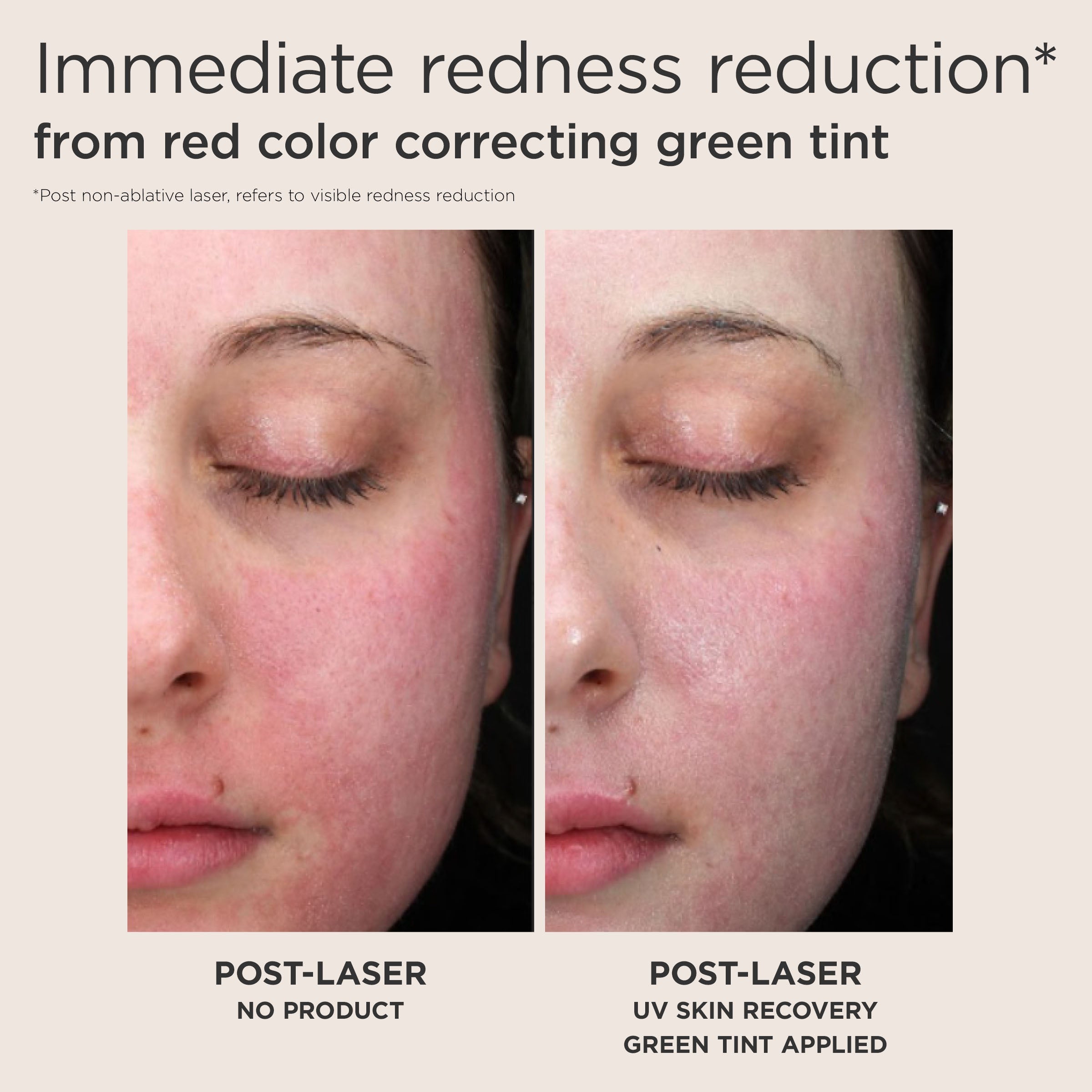 EltaMD UV Skin Recovery Red Color Correcting Green Tint Broad Spectrum SPF 50