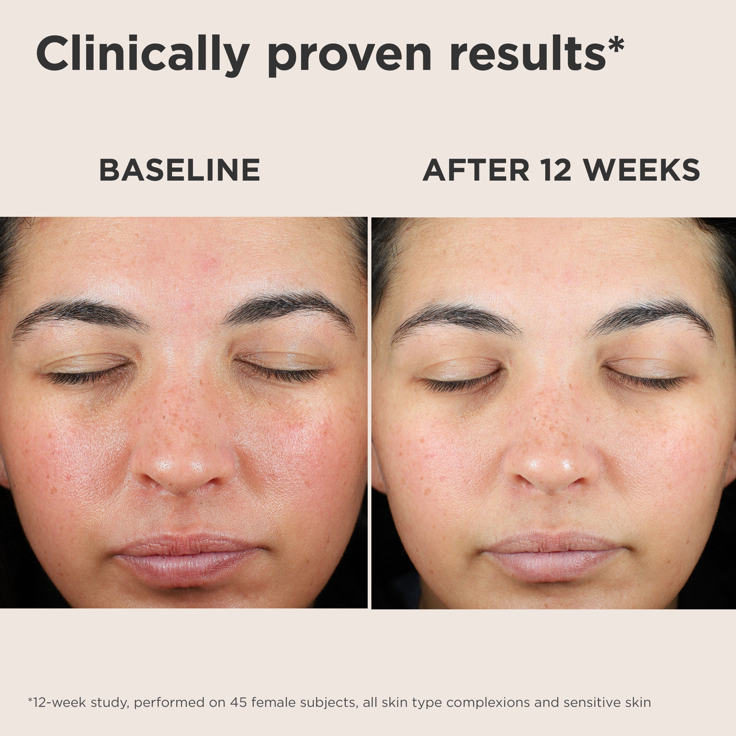 EltaMD UV Skin Recovery Broad Spectrum SPF 50 Face Sunscreen